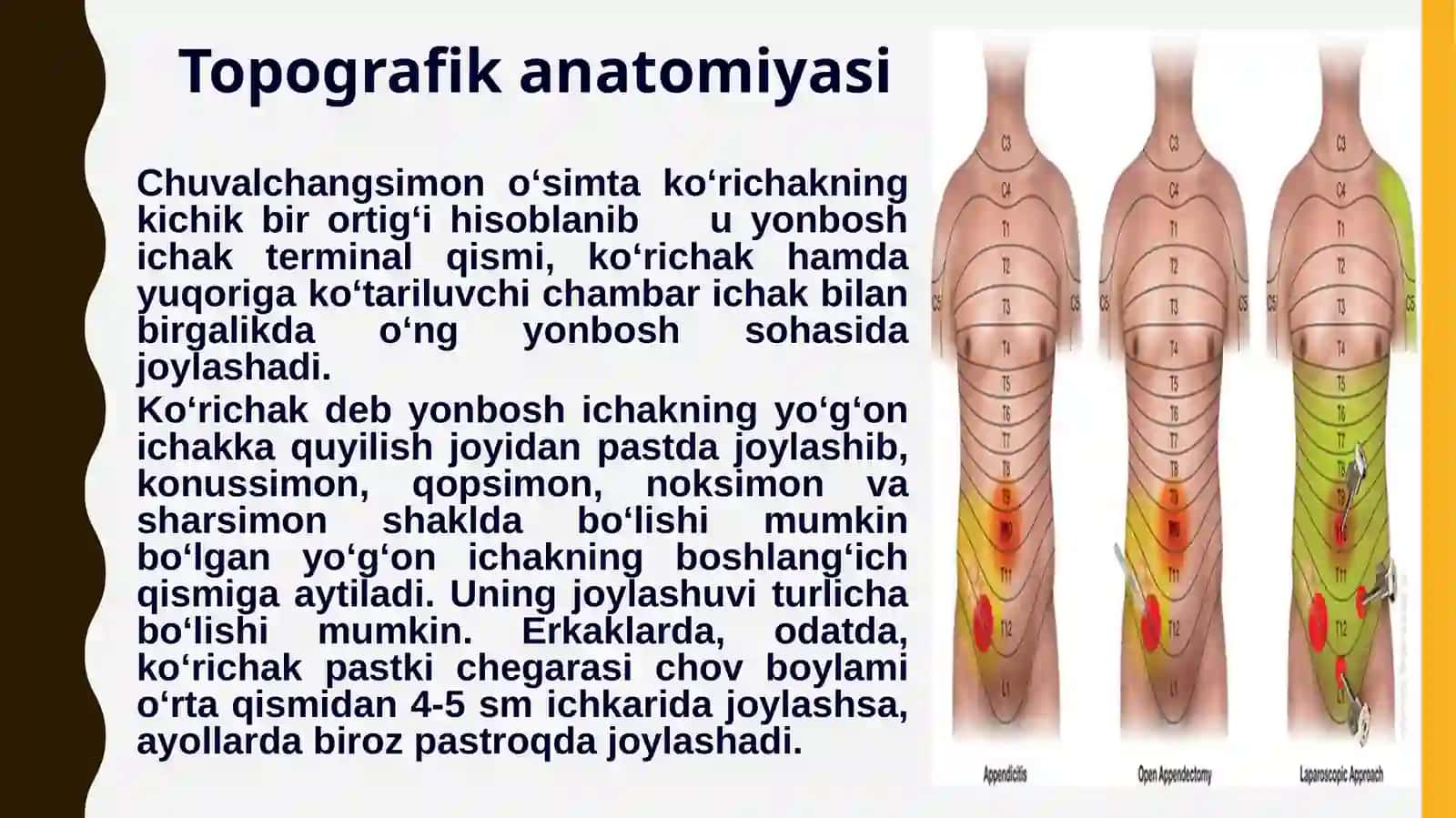 O'tkir appenditsit va uning asoratlari. Klinikasi, diagnostikasi va davolash usullari 3