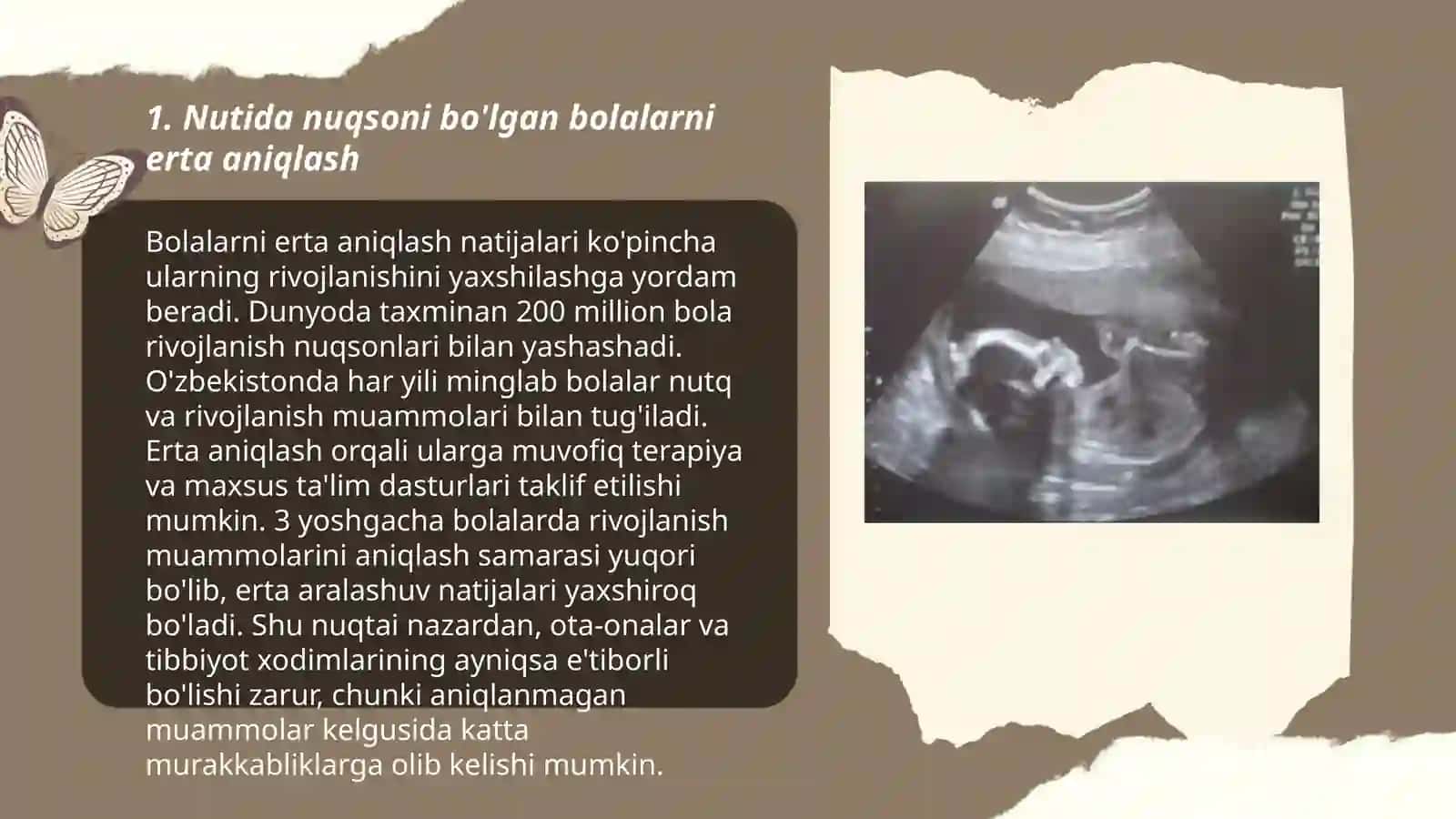 Nutida nuqsoni bo'lgan bolalarni tashxislash va reabilitatsiya qilish 3