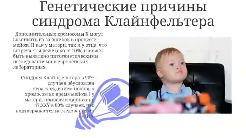 Синдром клайнфельтера 3
