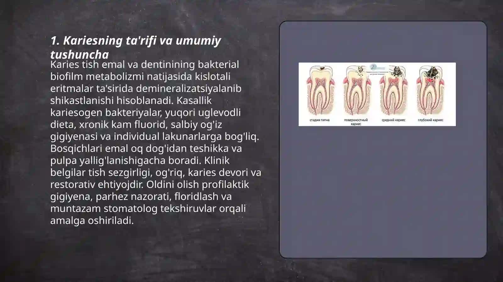 Karies haqida tushuncha 3