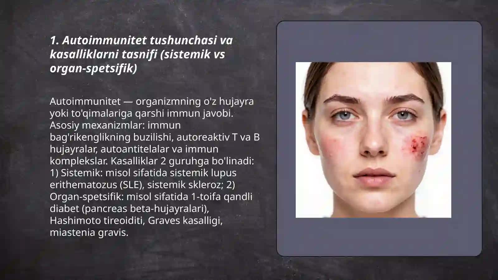 Autoimmun kasaliklari kelib chiqishi sabablari patofiziologik mehanizmlari, patogenezi, etiologiyasi klinik formalari 3