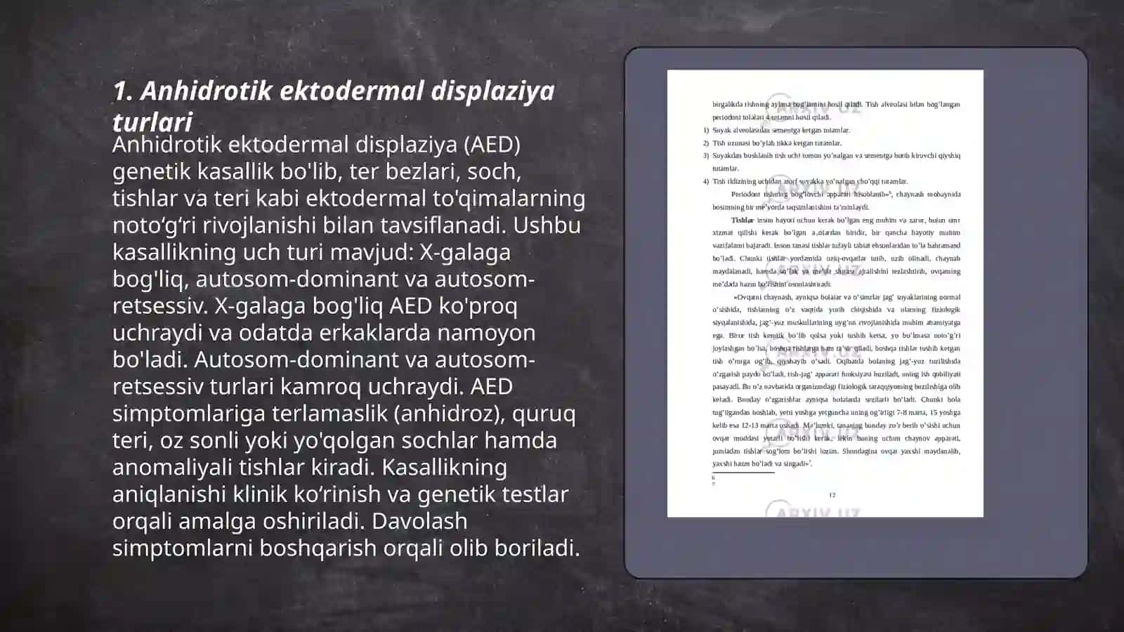 Angidrotik ektodermal displaziya buyicha kisman va kup tishlar yukotilganda yuztish tizimidagi o‘zgarishlar tasnifi 3
