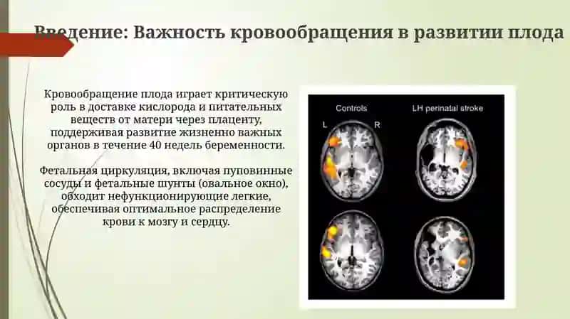 Кровообращение в утробе матери и изменения после рождения 3