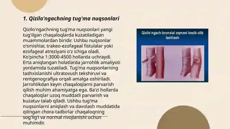 Qizilo'ngachning tug'ma va orttirilgan nuqsonlarida bajariladigan operatsiyalar 3