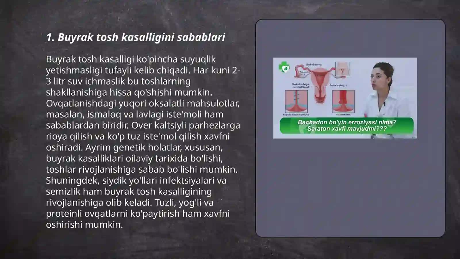 Buyrak tosh kasalligi 3