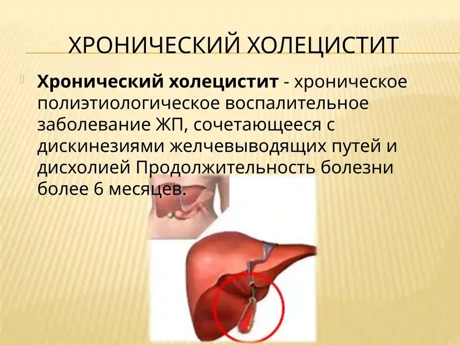 Хронический холецистит, дисфункция желчного пузыря, Спазм сфинктера Одди, хронический панкреатит 3