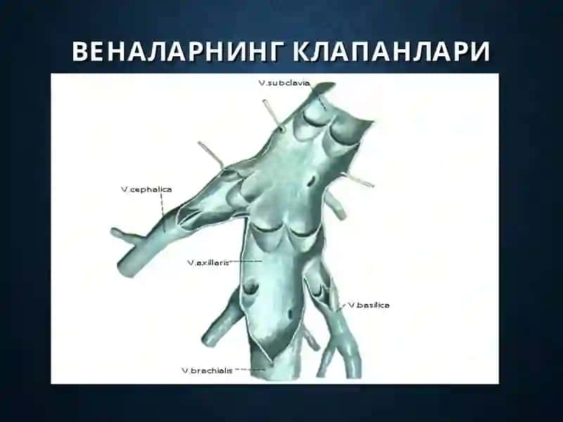 Оyoq venalarini varikoz kasalligi 3