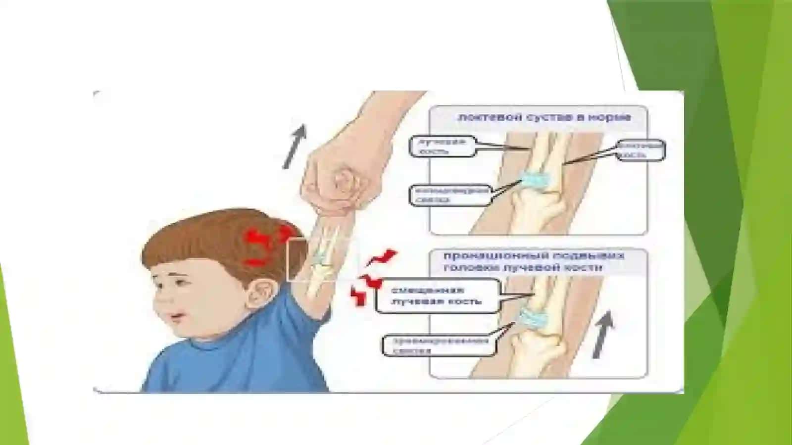 Bolalarda suyak va mushak tizimi embriongez 3