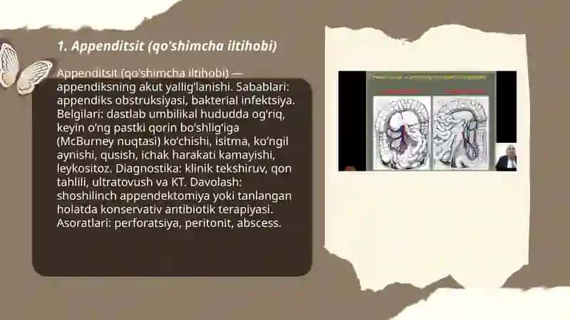 Qorin bo'shlig'i kasalliklari 3