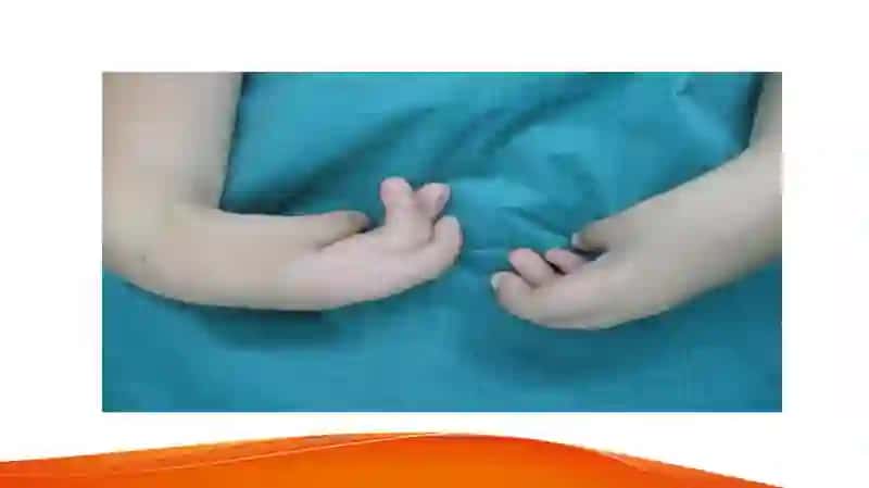 Arthrogryposis 3