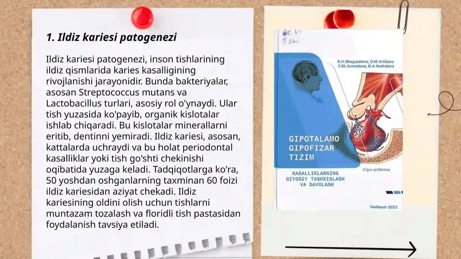 Ildiz kariesi: Kilinikasi Davolash Tashxislash 3