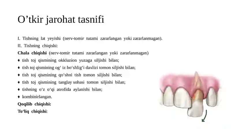 Tish chiqqandan keyin paydo bo’luvchi nokarioz kasalliklar. Tish jarohatlari. Etiologiya. Klinika. Diagnostika. Davolash 3