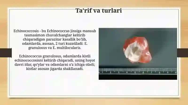 Ekinokokkoz epidemiologiyasi, profilaktikasi va epidemiyaga qarshi chora- tadbirlar 3