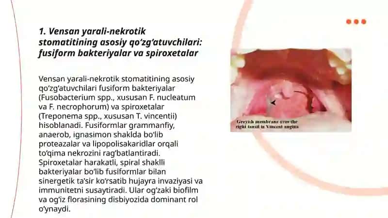 Vensan yarali-nekrotik stomatiti qo‘zg‘atuvchilari.laborator tekshirish usullari.profilaktikasi 3
