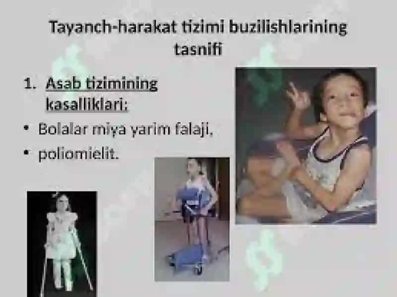 Tayanch-xarakat apparatidanuqsonibo‘lgan bolalar uchun inkluziv ta'lim strategiyalari vaularni amalga oshirish shartlari 3