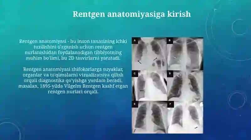 Hazm a'zolarining rentgen anatomiyasi va rivojlanish nuqsonlari 3