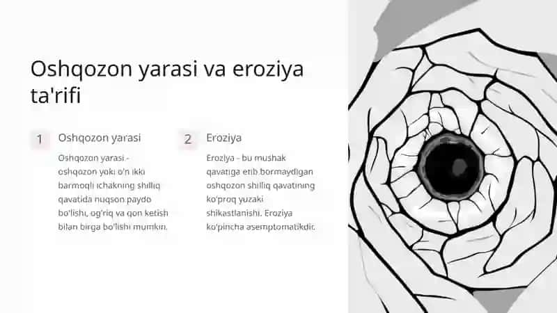 Oshqozon yarasi va oshqozon eroziyasi 3