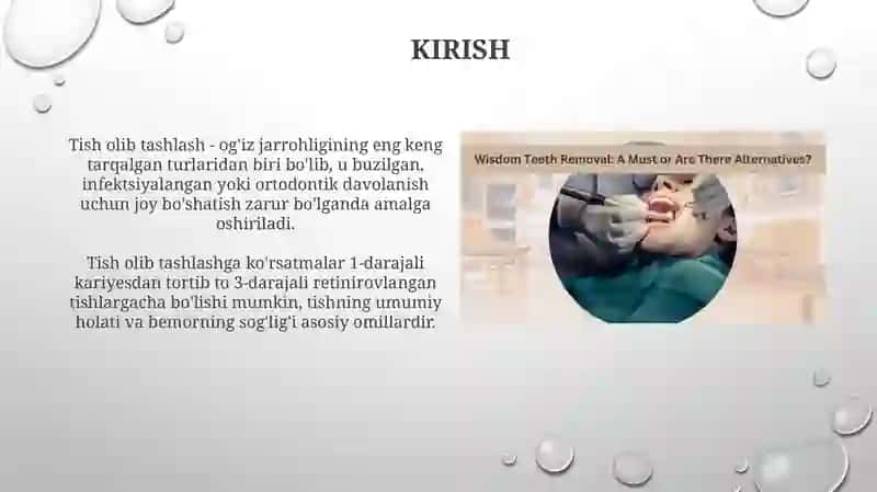 Tish olish operatsiyalari 3