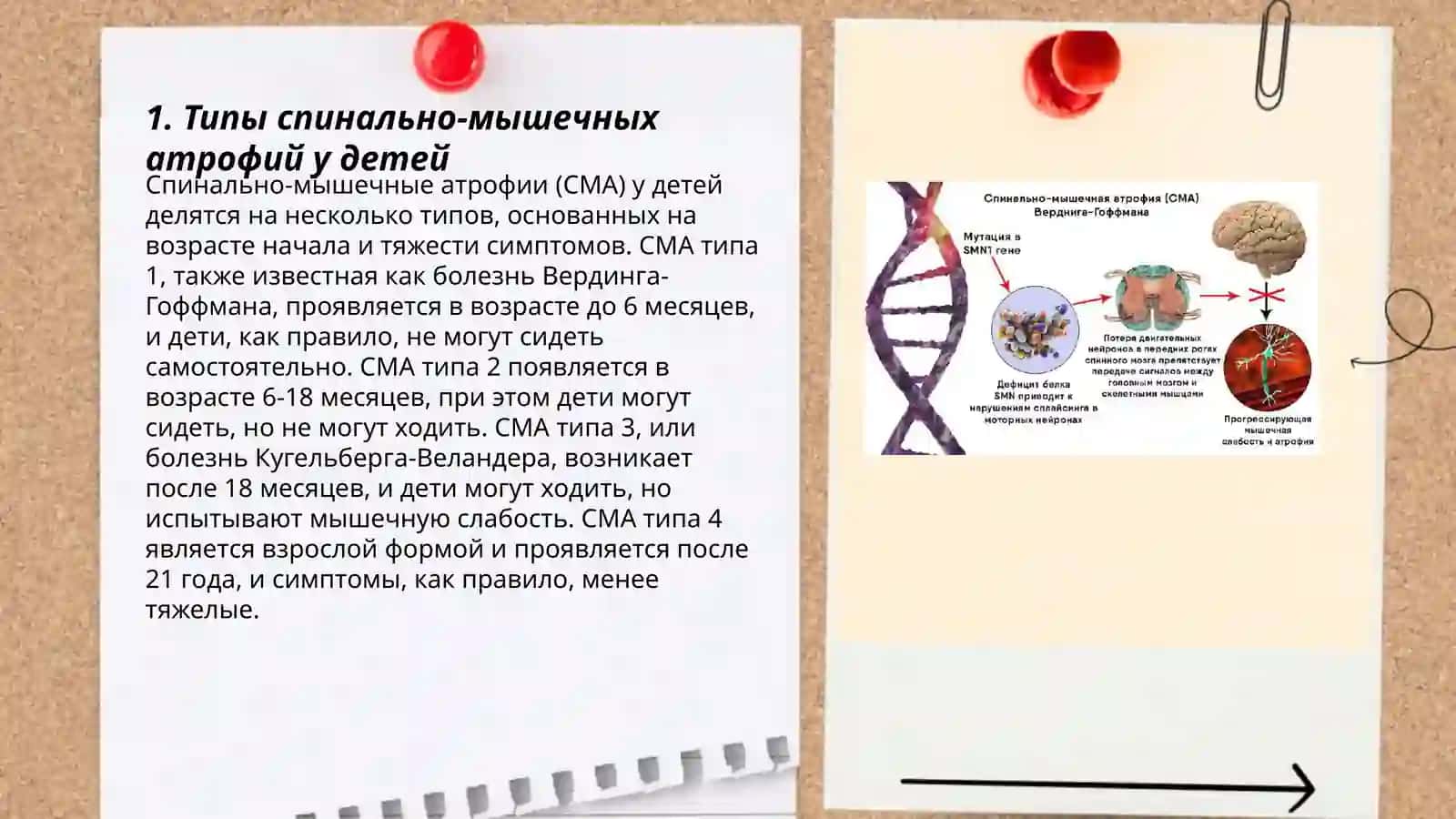 Спинально-мышечные атрофии у детей 3