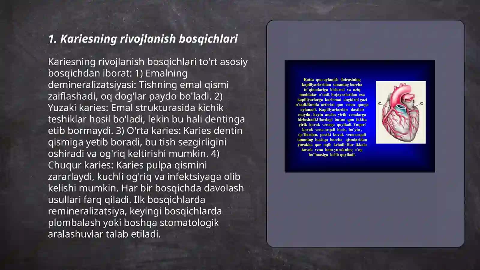 Kariesogen omillar (mahalliy umumiy). Kariesni patologik anatomiyasi 3