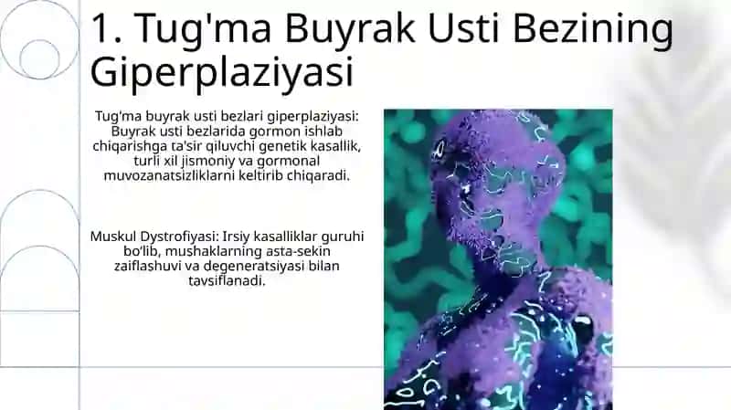 Tug'ma Buyrak Usti Bezining Giperplaziyasi 3