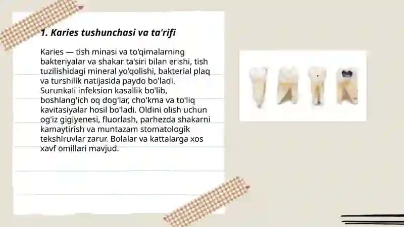 Karies tushunchasi 3