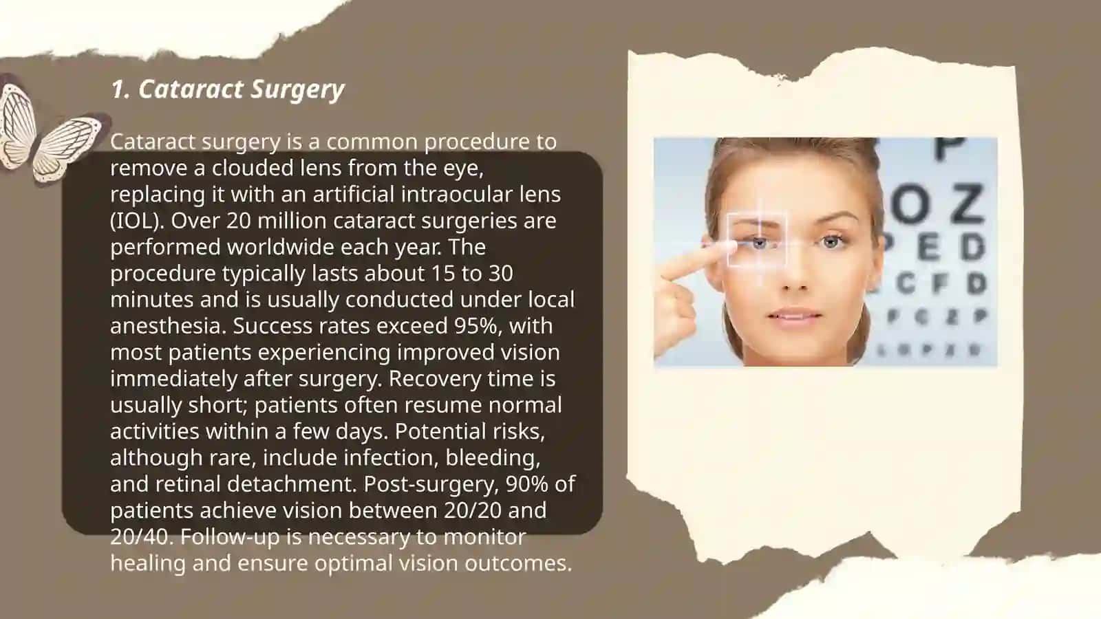 Cataract Surgery 3
