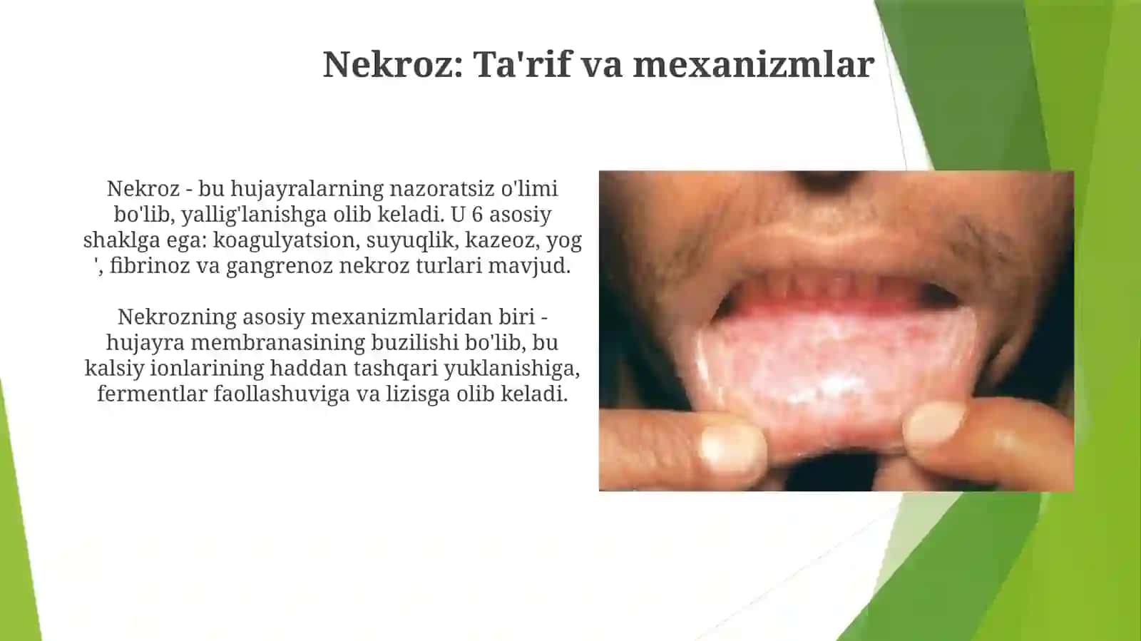 Nekroz va Apoptoz: Asosiy Tushunchalar va Mexanizmlar 3