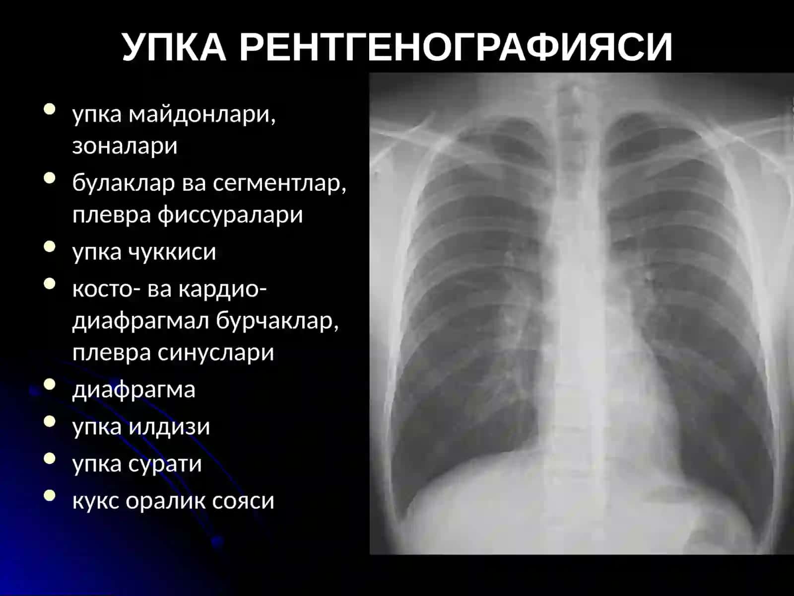 Упка Касалликларининг Нур Ташхиси 3
