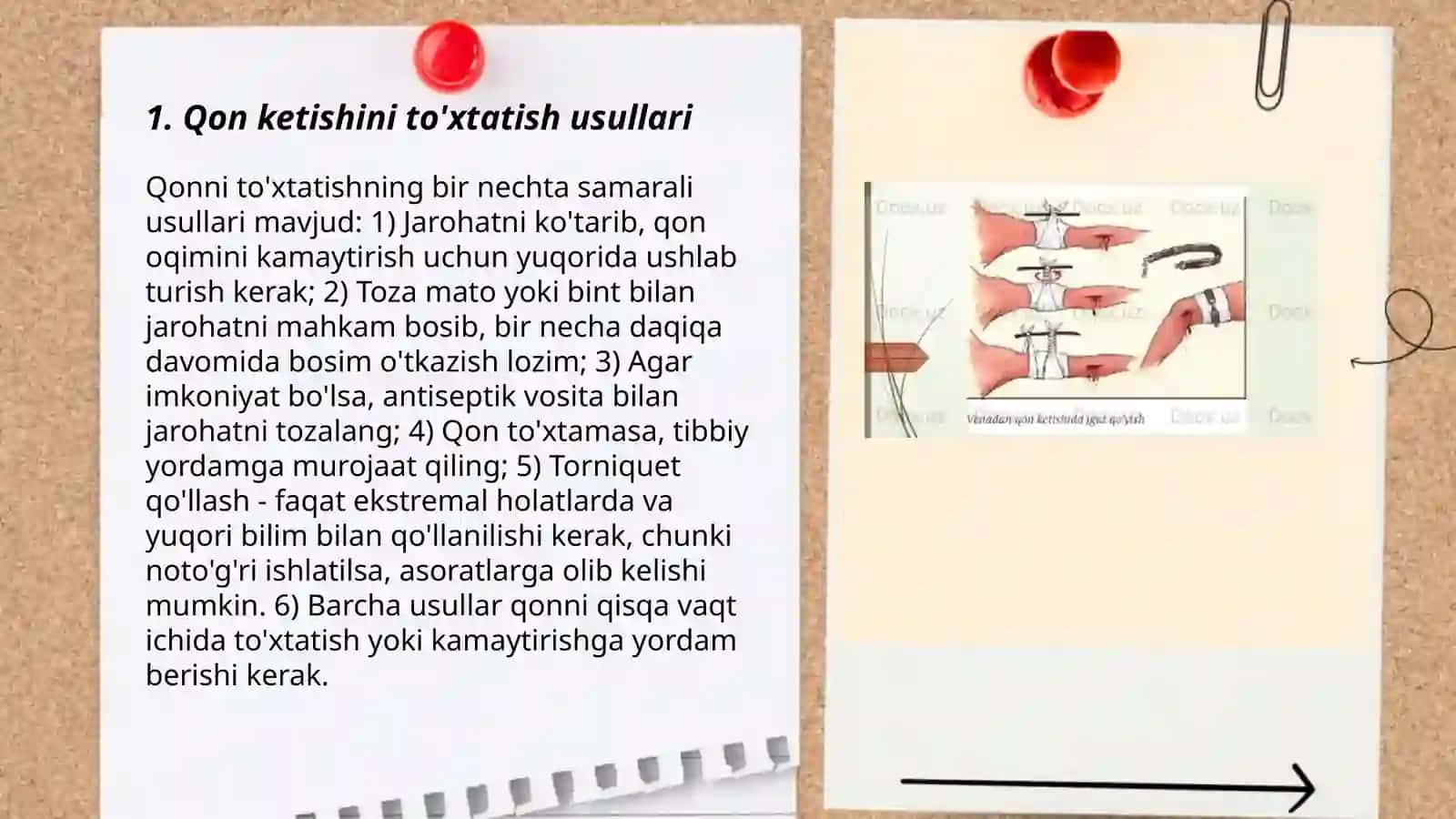 Qon ketishida birinchi tibbiy yordam ko’rsatish 3
