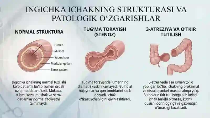 O'trir ingichka ichak tutilishida, tug'ma torayishlarda va 3 atreziyalarda bajariladigan operatsiyal 3