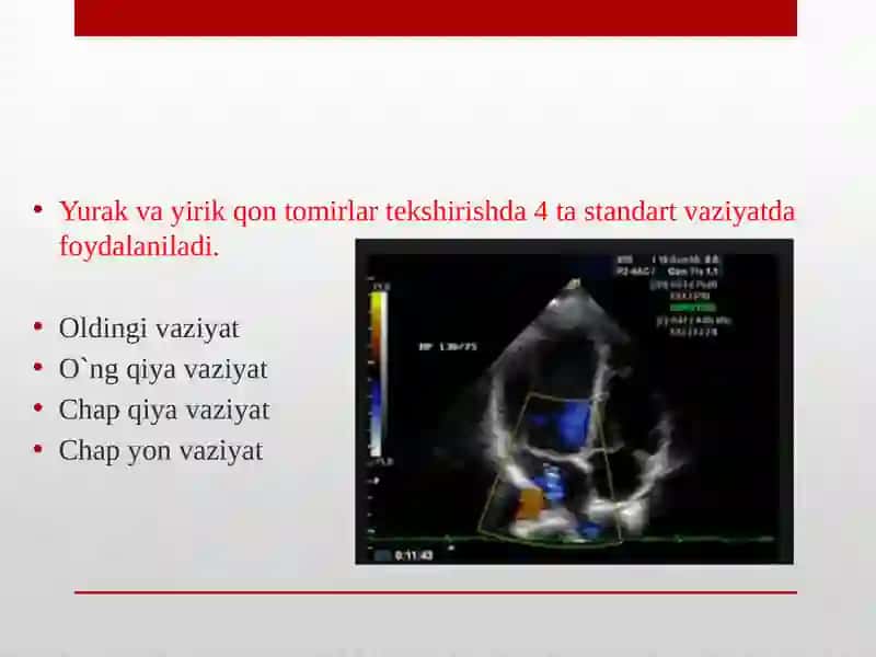 Yurak va yirik qon tomirlari tekshirishi 3