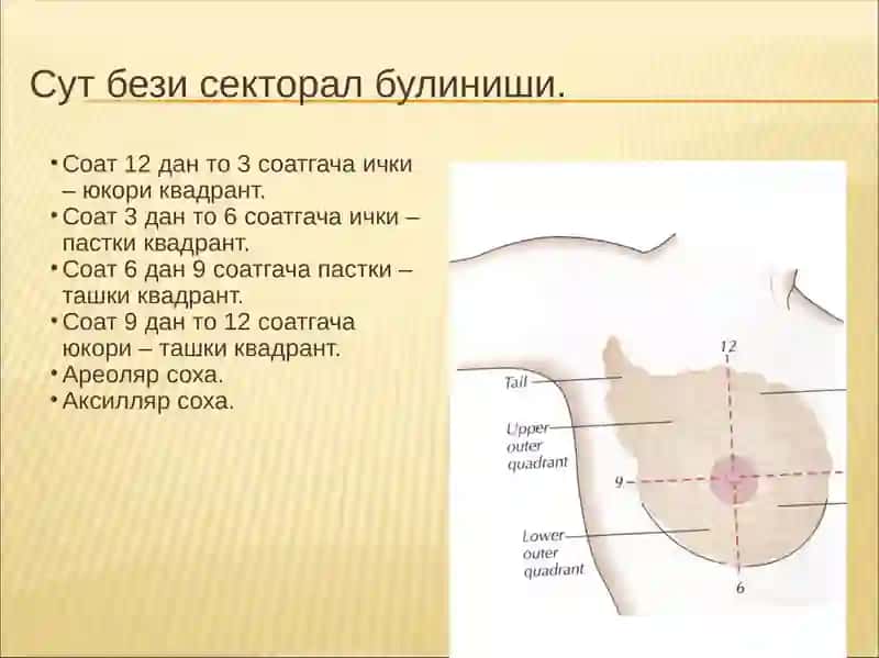 Sut bezi oʻsmalari 3