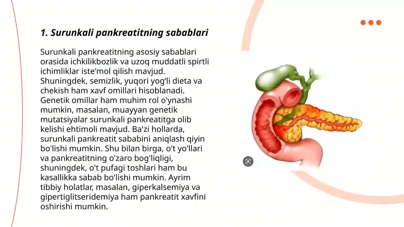 Surunkali pankreatit kasalligi 3