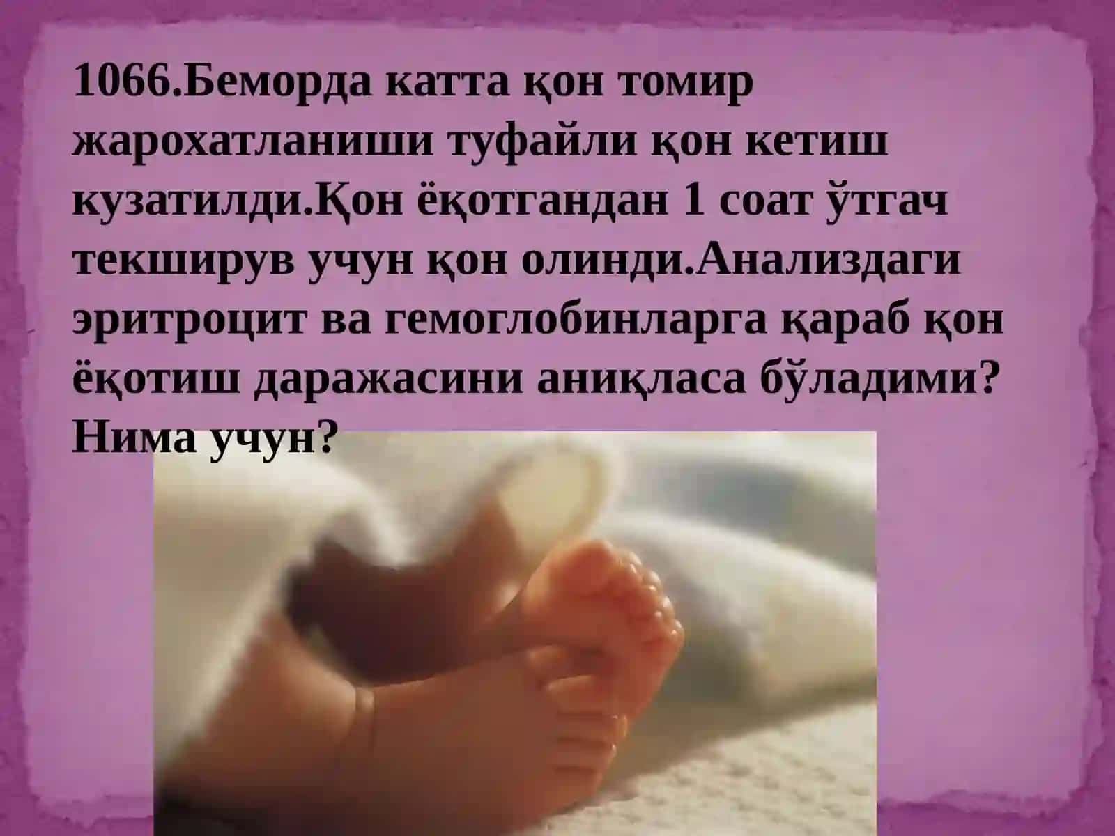 Анемия 3