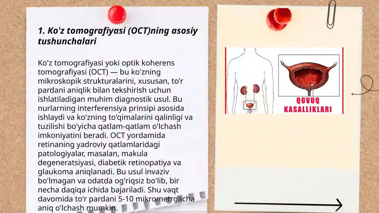 Ko'z tomografiyasi (OCT)va ko’z kasalliklarini tashxislash 3