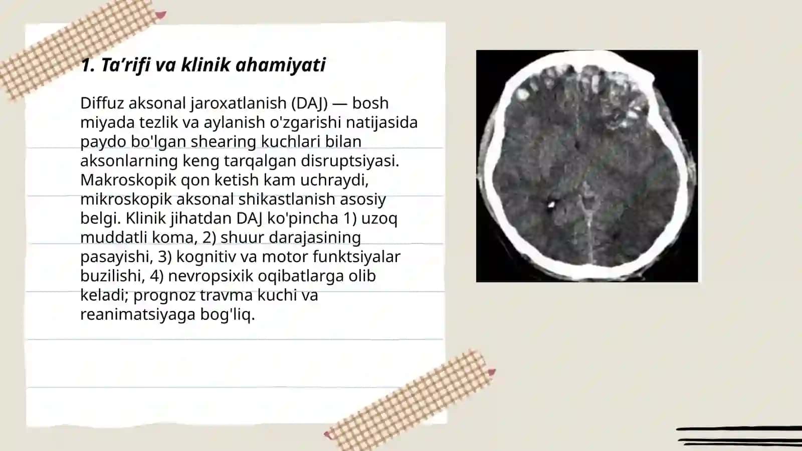 Bosh miyya diffuz aksonal jaroxatlanishi 3