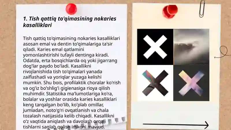 Tish qattiq to'qimasining nokaries kasalliklarda restavratsiyaning klinik tamoyillari 3