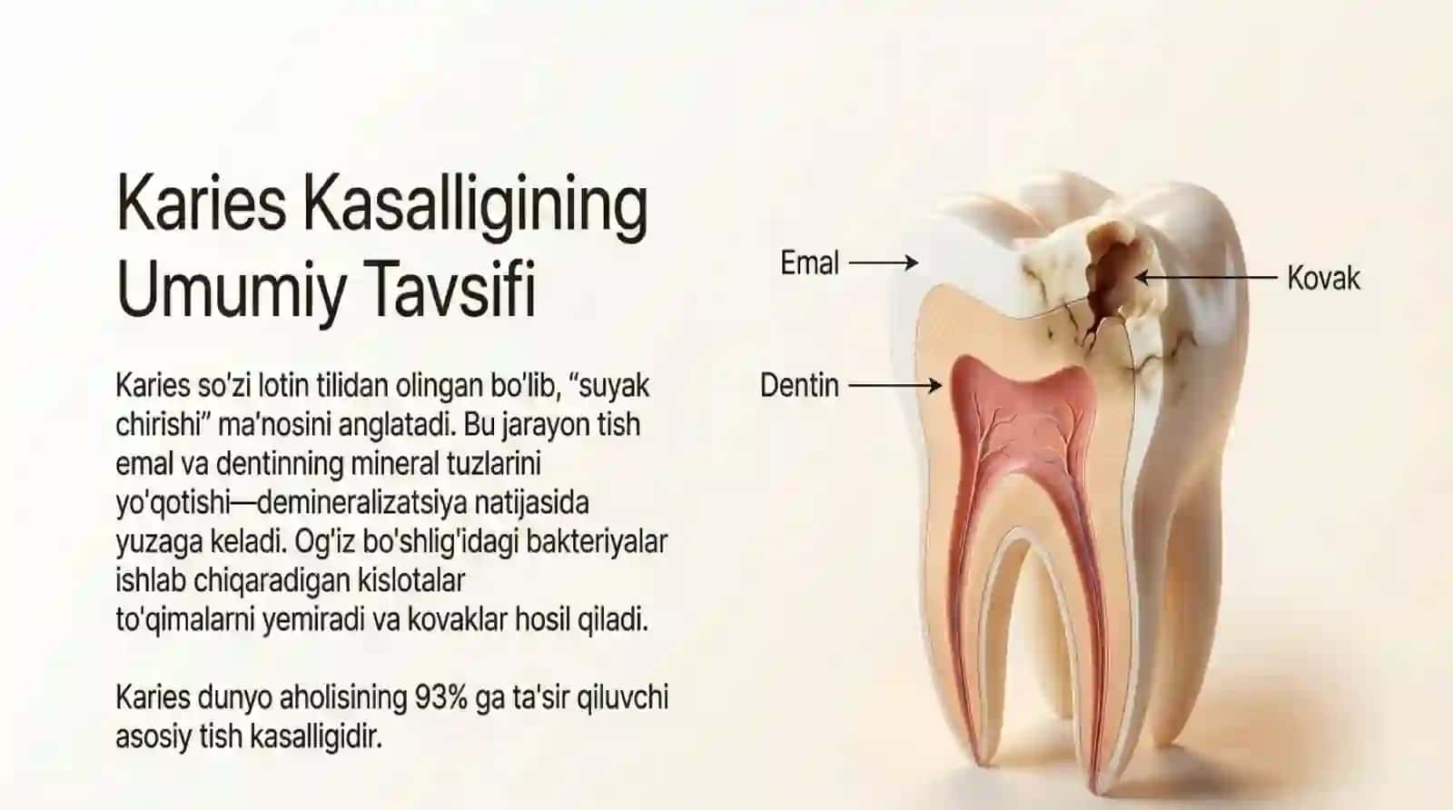 Karies kasalligini umumiy davolash. Karies va ovqatlanish, fizik davolash usullari, kasallik tarixi 3