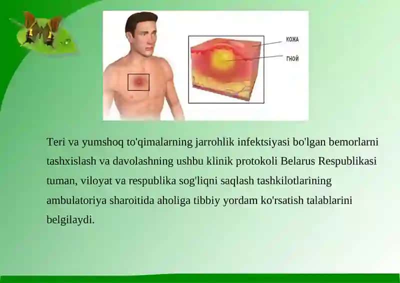 Yusupova | Sarvinozning xirurgiya fanidan tayyorlagan mustaqil ishi 3