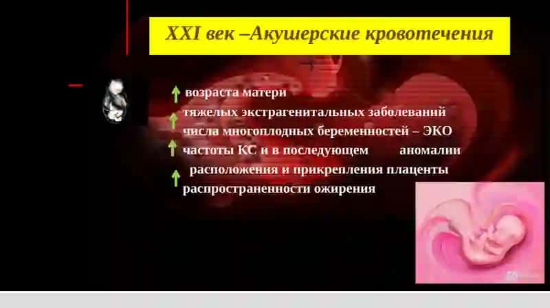 Инновационные методы лечения и профилактики акушерских кровотечений 3