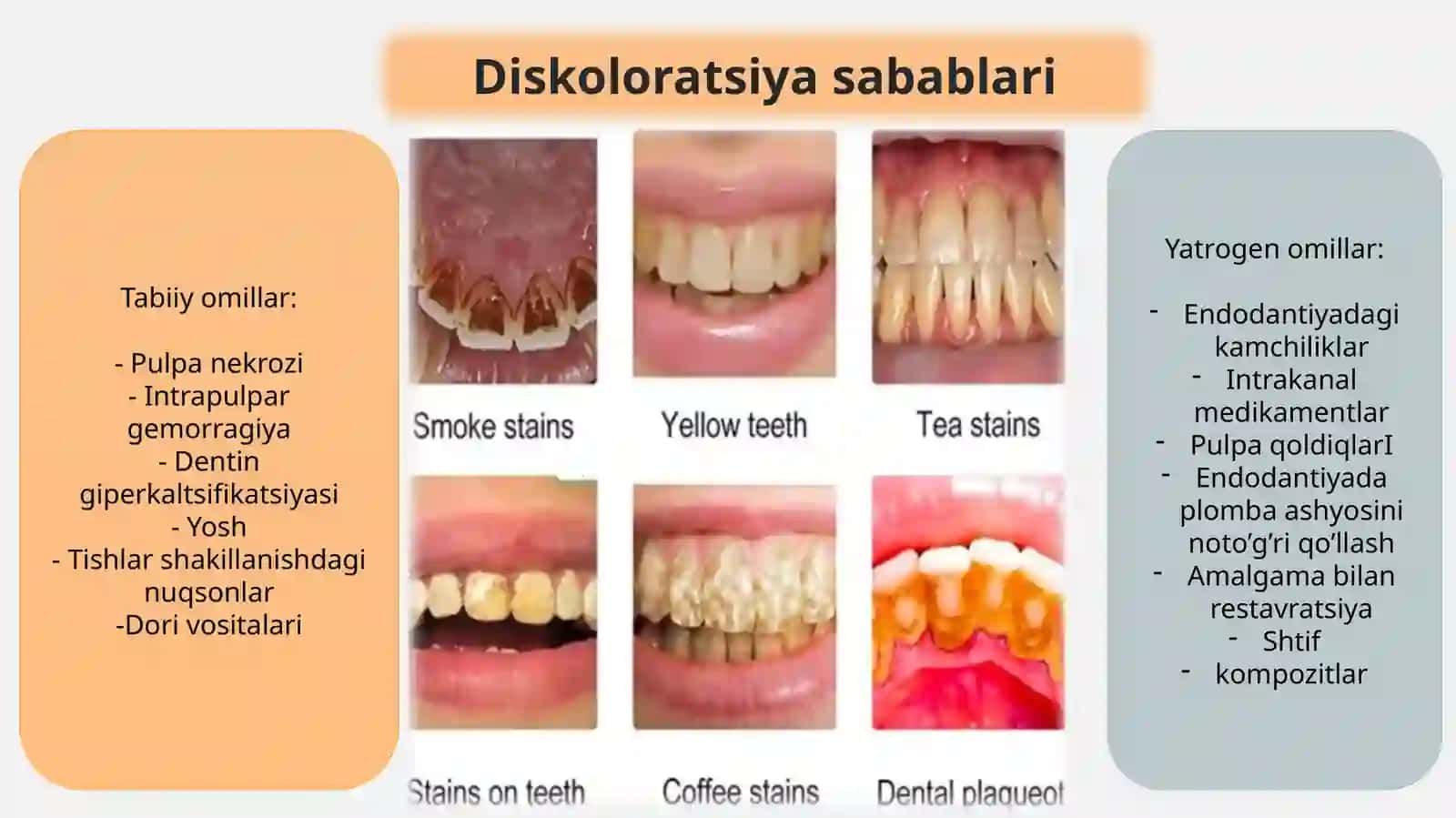 Tishlarni oqartirish usullari 3