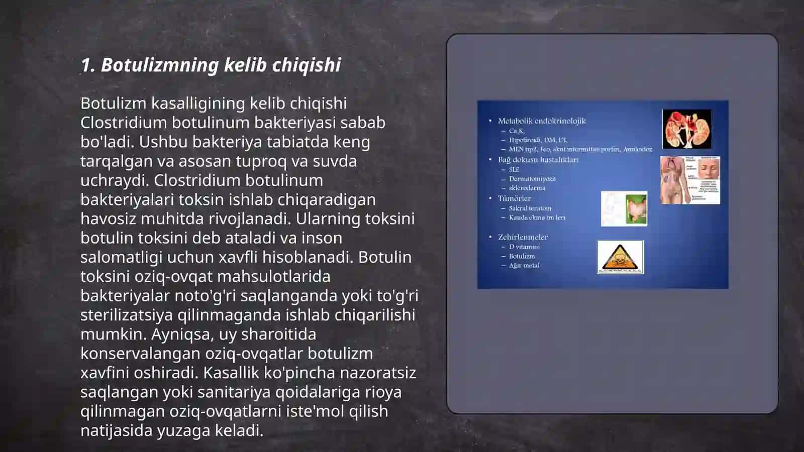 Botulizm, ovqat toksikoinfeksiyasi 3