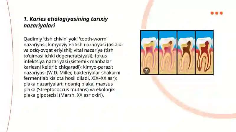 Tish kariesi sabablari kelib chiqish nazariyalari 3