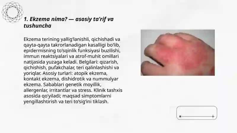 Ekzema kasalligi bo’yicha to’liq tushuntirish 3