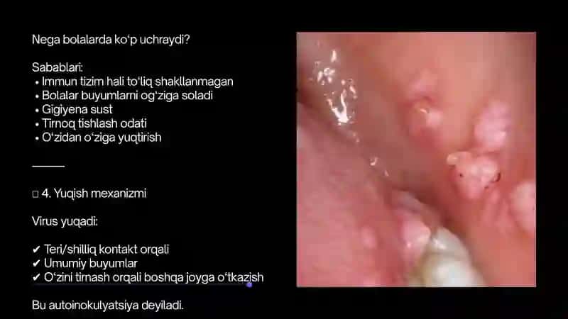 Virusli so‘gallar 3