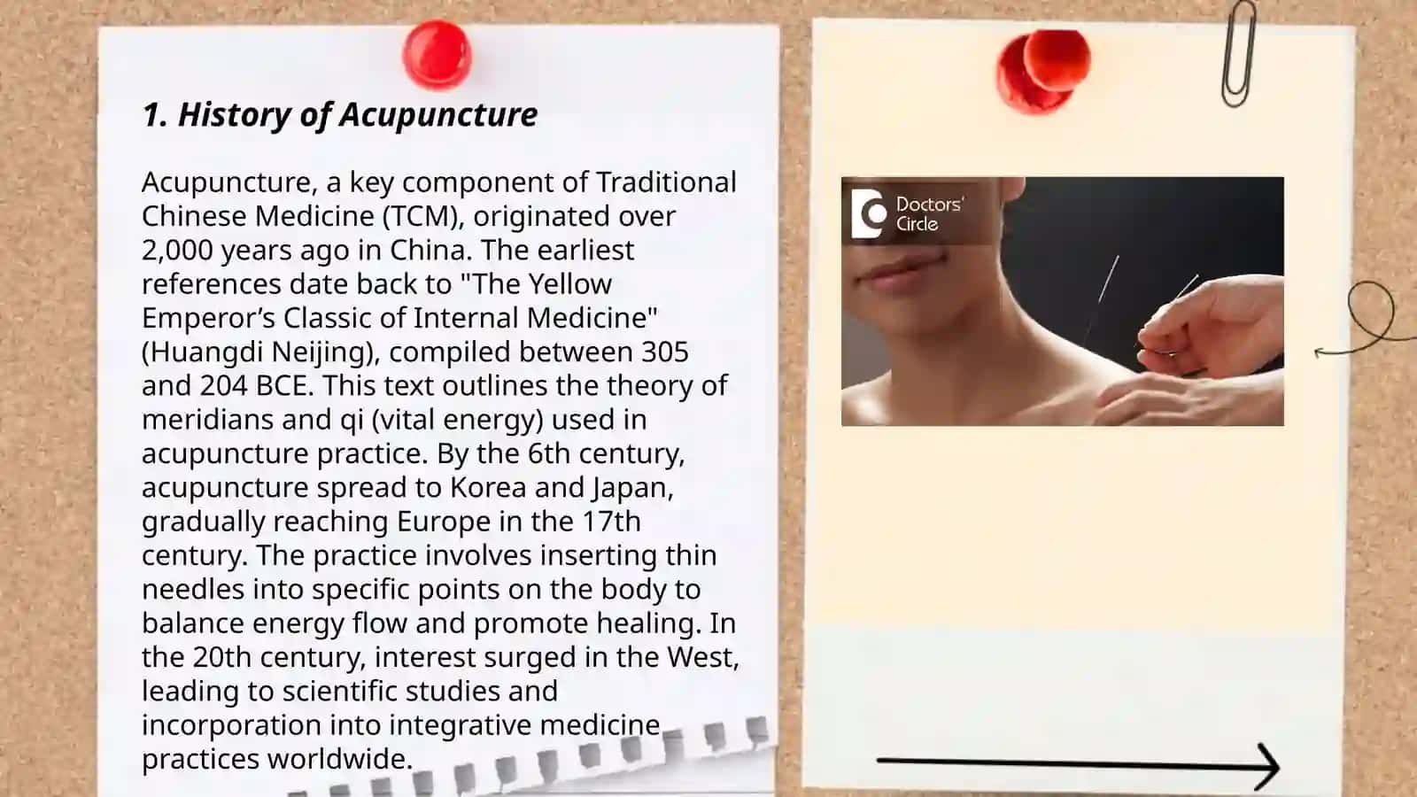 History of Acupuncture 3