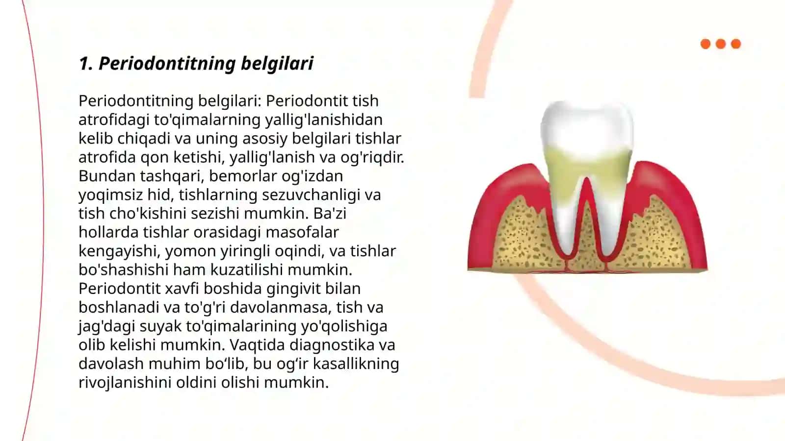 Periodontit 3