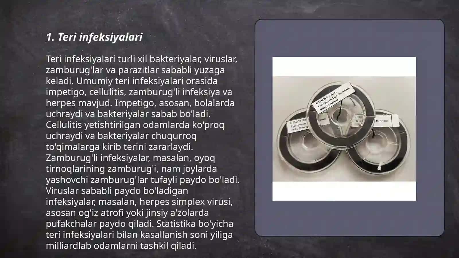 Teri parazetar kassaliklari 3
