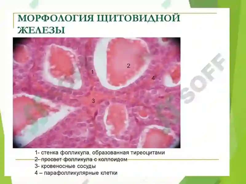 СЎРАБ СУРИШТИРИШ 3